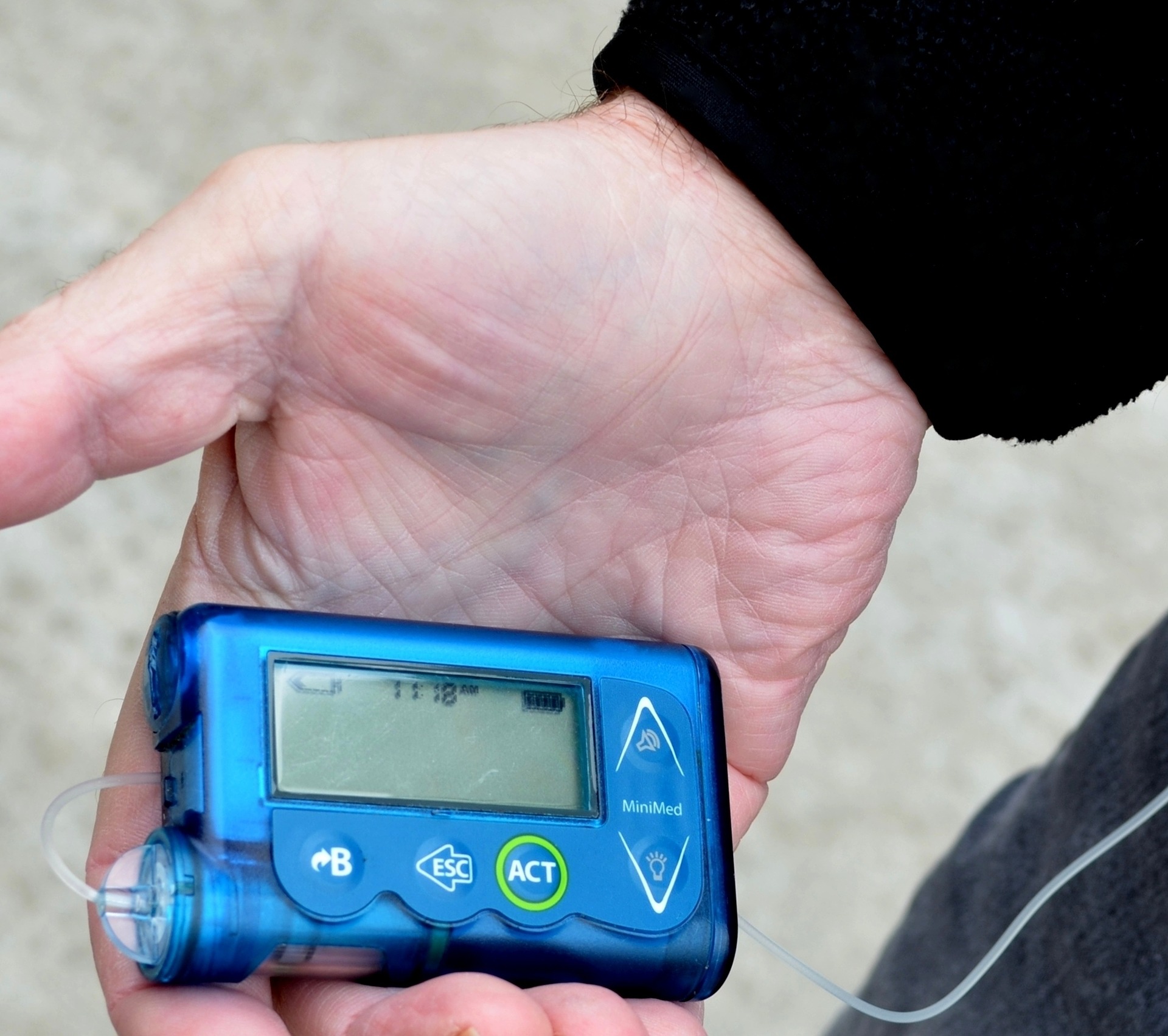 A portable insulin auto-injector